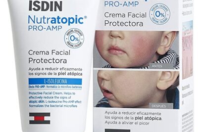 Piel atopica bebe